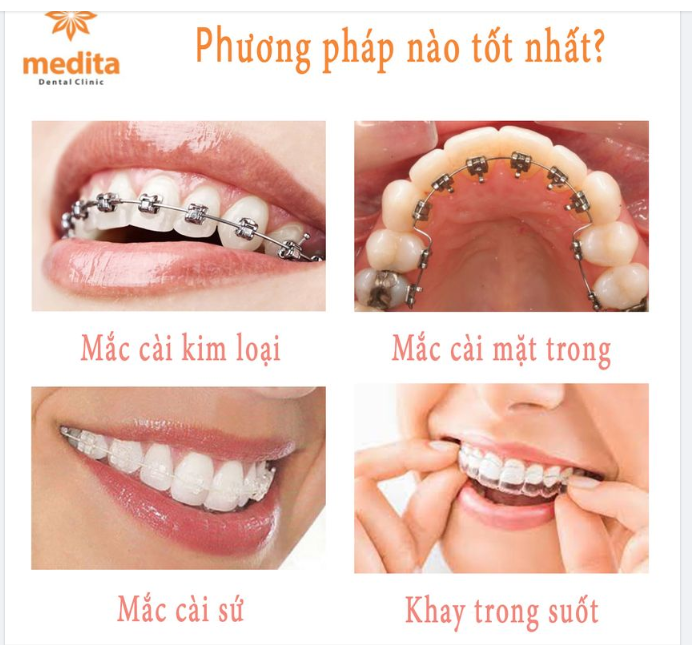 PHƯƠNG PHÁP NIỀNG NÀO LÀ TỐT NHẤT?