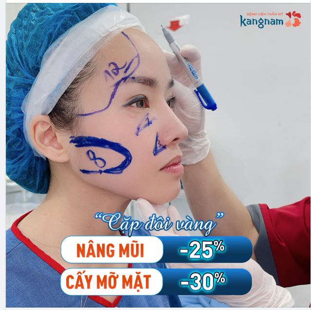 Chị khách nâng mũi xong rất ưng ý, nay quay lại cấy mỡ mặt