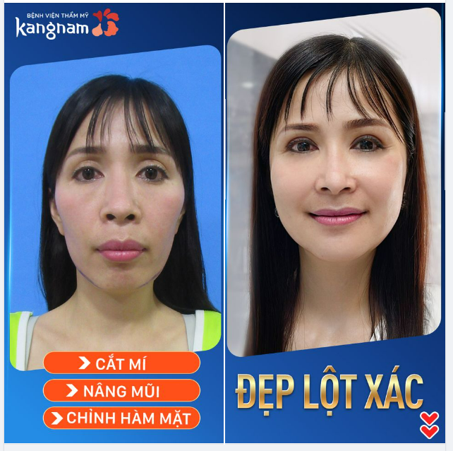 "Vịt giời" hóa "thiên nga" - Đẹp 360 độ luôn ạ!