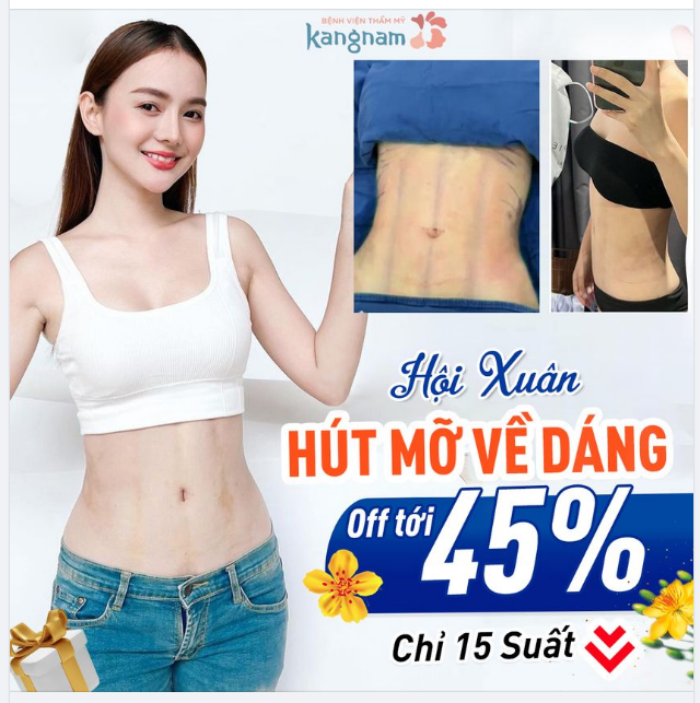 HỘI XUÂN GIẢM MỠ - Đăng ký đặt lịch ngay!