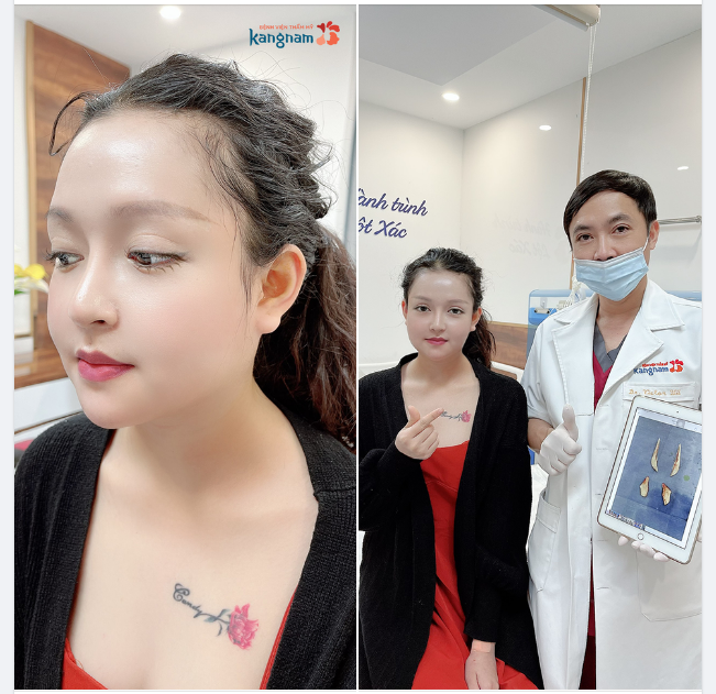 Thu gọn hàm Vline xong xinh như Hotgirl. Đúng nhận sai làm sao được!