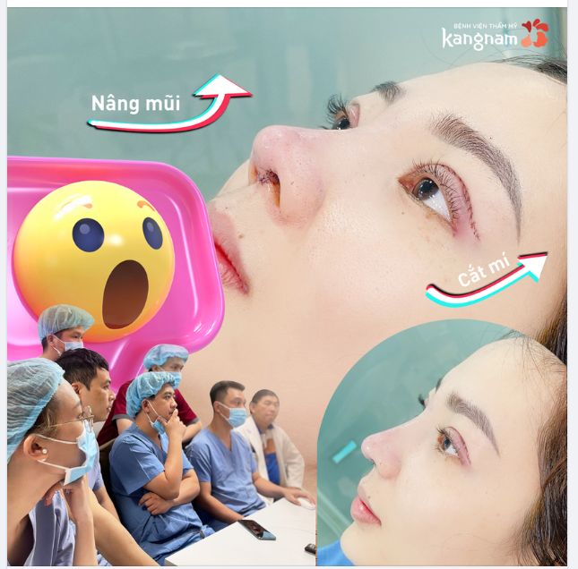 Thẩm mỹ vừa xong - Trầm trồ luôn ạ!