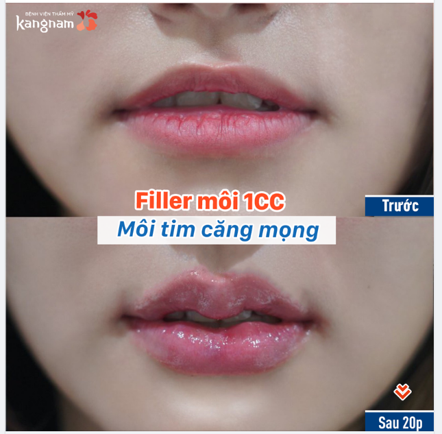 Một chiếc môi tim xinh xỉu chỉ sau 20p - Giá cực "yêu"