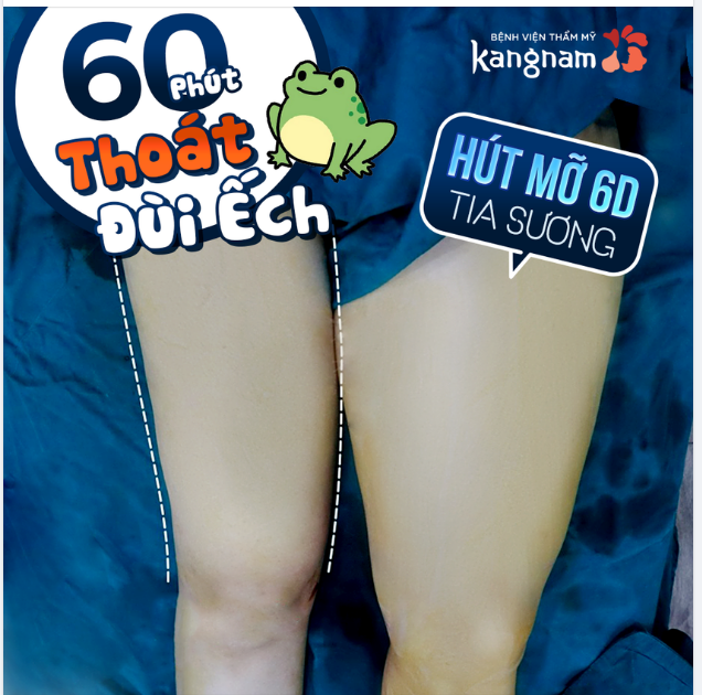 Đùi ếch chớ lo - Kangnam "cân" hết
