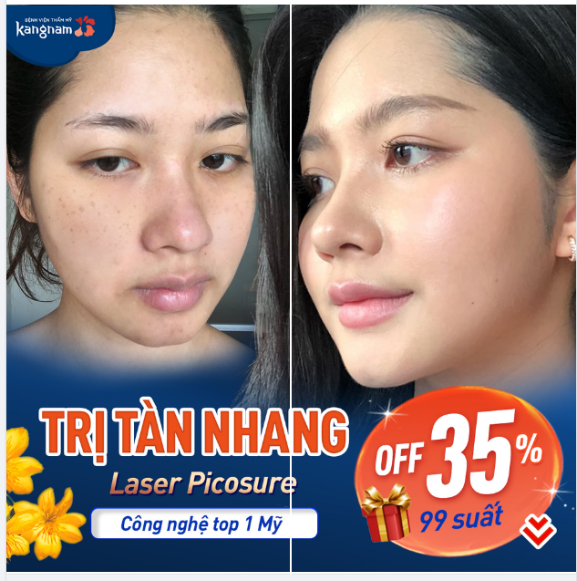 Công nghệ hàng đầu, thổi bay 95% tàn nhang