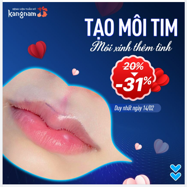Duy nhất 14/02 - Ngày Yêu nhận Sale Yêu