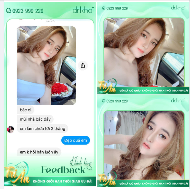 "Dáng mũi ngày càng tự nhiên, gặp ai cũng thấy tự tin hơn hẳn"
