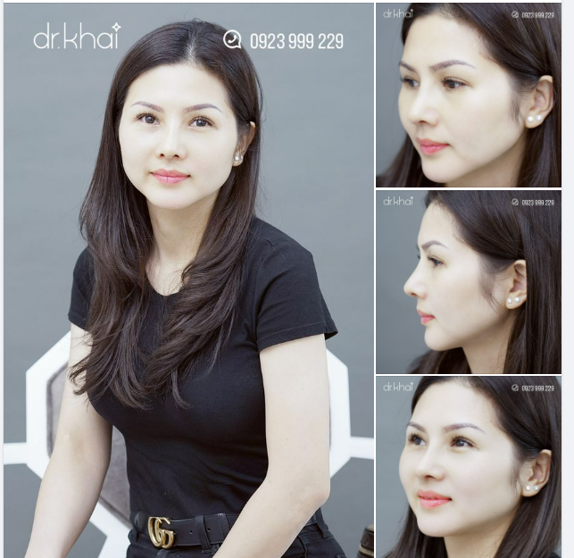 NGẤT NGÂY VỚI DIỆN MẠO MỚI CỦA KHÁCH