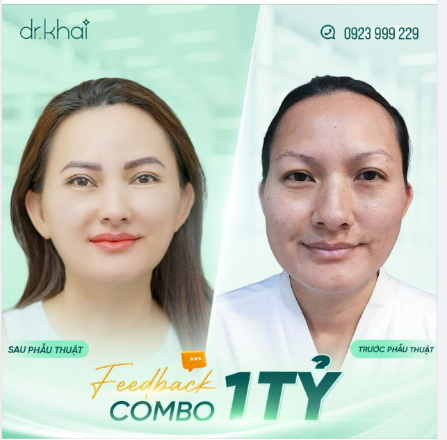 KHÁCH HÀNG CHI 1 TỶ LÀM ĐẸP