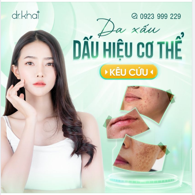 CƠ THỂ “KÊU CỨU” KHI DA GẶP NHỮNG TÌNH TRẠNG DƯỚI ĐÂY