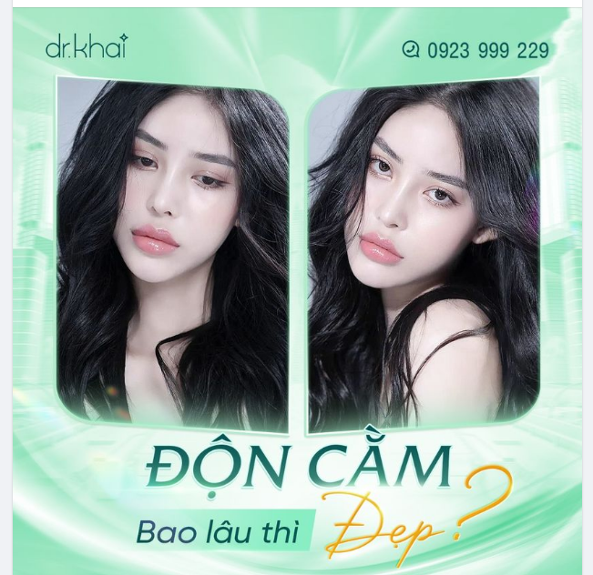 ĐỘN CẰM BAO LÂU THÌ ĐẸP?