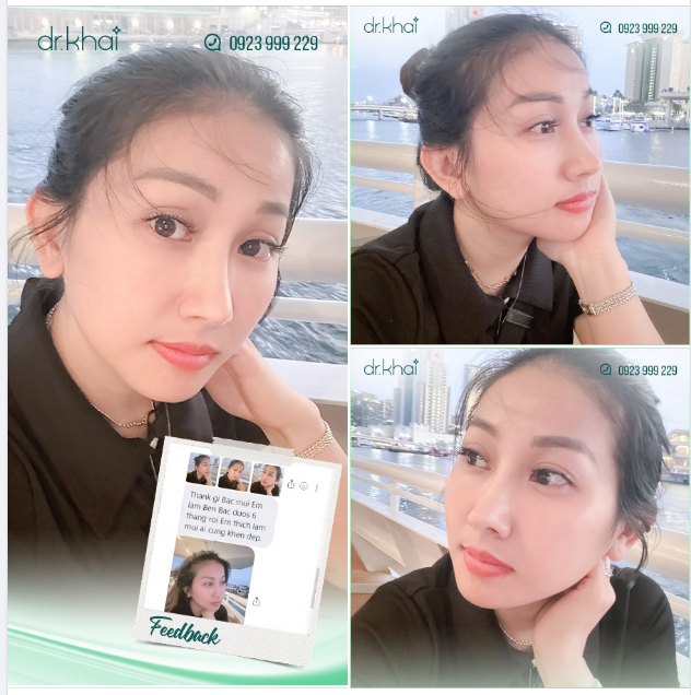 KHÁCH Ở MỸ GỬI FEEDBACK CHO BÁC SĨ KHẢI