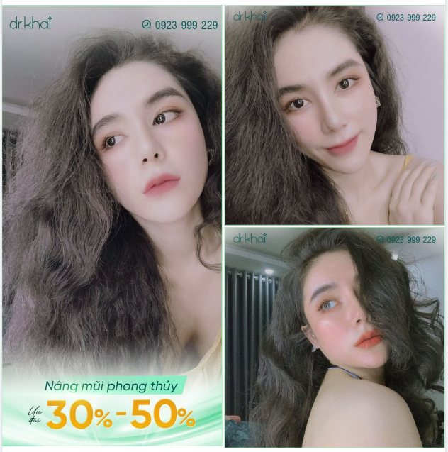 "NHIỀU VẬN MAY BẤT NGỜ TỪ KHI NÂNG MŨI PHONG THỦY TẠI BÁC SĨ KHẢI"