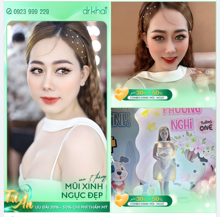 MŨI XINH - NGỰC ĐẸP SAU 3 THÁNG