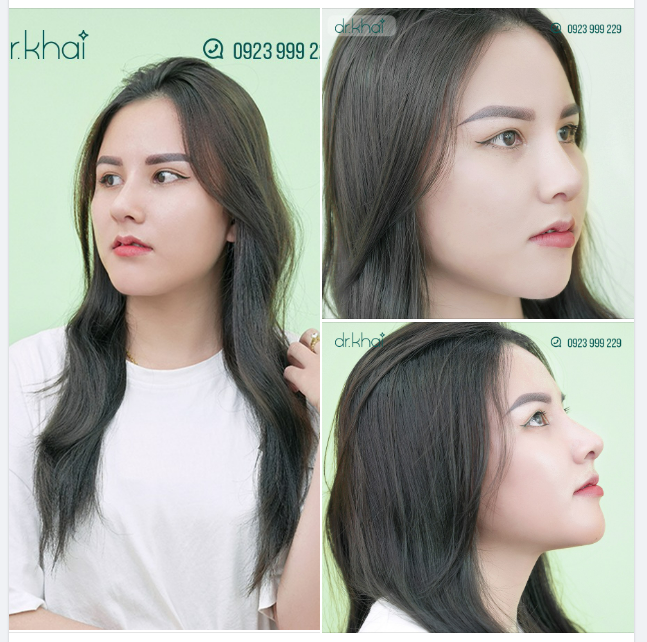BẮT CẬN GÓC MŨI ĐẸP MÊ LY CỦA KHÁCH HÀNG