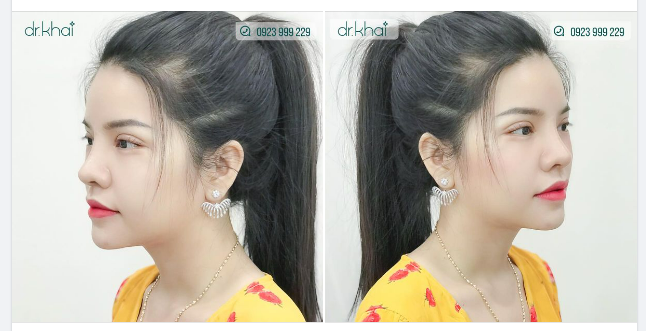 MÍ ĐẸP CHO GƯƠNG MẶT TRẺ TRUNG