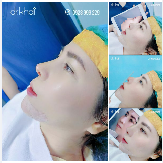 COMBO THẦN THÁNH NÂNG MŨI - ĐỘN CẰM