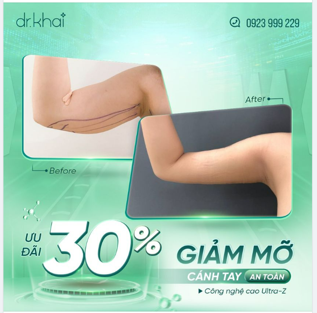 CÁNH TAY THON GỌN CHỈ SAU 60 PHÚT