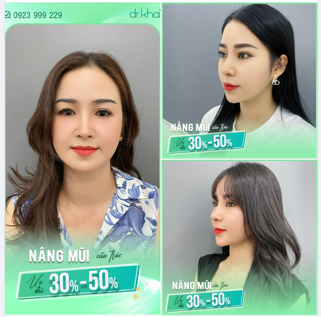 HÌNH ẢNH KHÁCH YÊU NÂNG MŨI CẤU TRÚC TẠI BỆNH VIỆN NAM AN CỦA BÁC SĨ KHẢI
