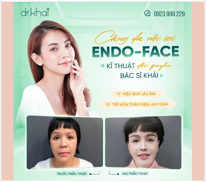 CĂNG DA NỘI SOI ENDO-FACE ĐỘC QUYỀN BÁC SĨ KHẢI