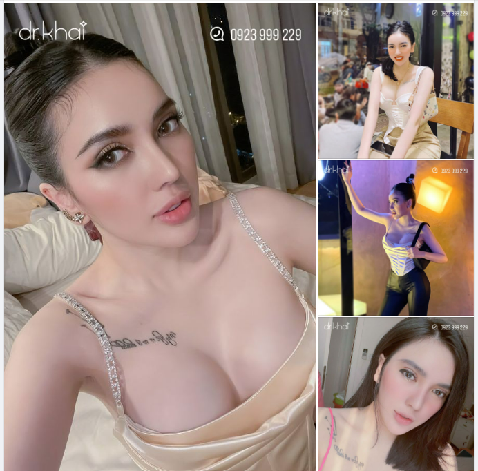 HOTGIRL SANG XỊN VỚI COMBO NÂNG MŨI - NÂNG NGỰC