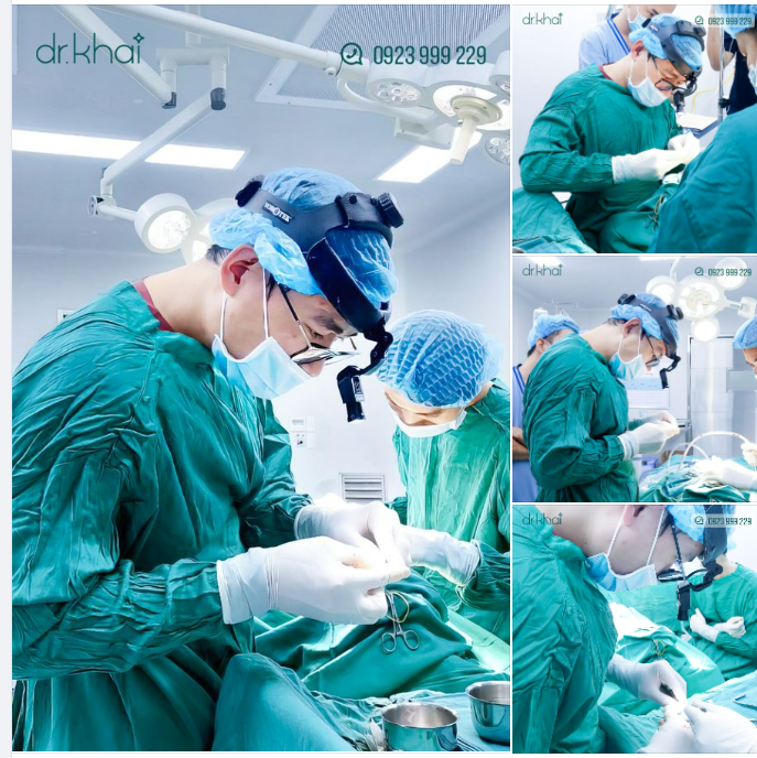 BÁC SĨ KHẢI THỰC HIỆN NÂNG MŨI SỤN SƯỜN