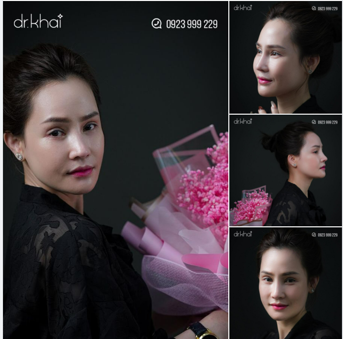 ĐẸP HOÀN HẢO VỚI SIÊU COMBO 200 triệu