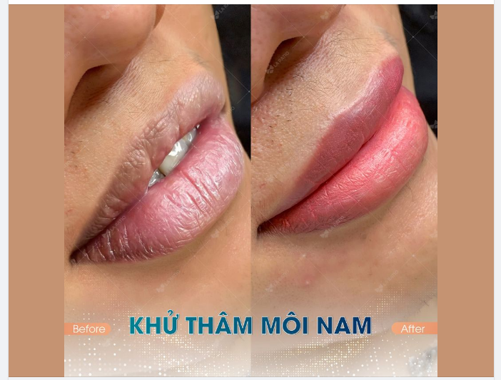 Nụ cười bạn là nắng. Vì chỉ cần bạn cười là đã đủ để sưởi ấm lòng tôi