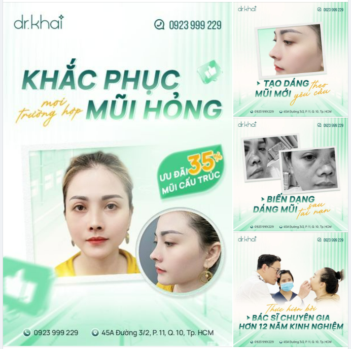 BÁC SĨ KHẢI KHẮC PHỤC TÌNH TRẠNG MŨI HỎNG - MŨI BIẾN DẠNG