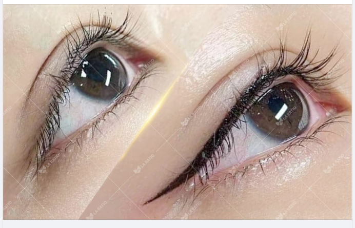 Thay đổi khác biệt ngay sau khi phun mí  Đẹp sắc sảo và tinh tế