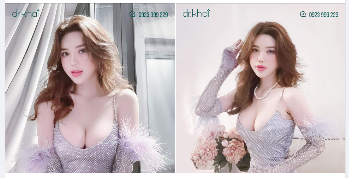 NÂNG NGỰC 2 NĂM - CÀNG NGÀY CÀNG ĐẸP