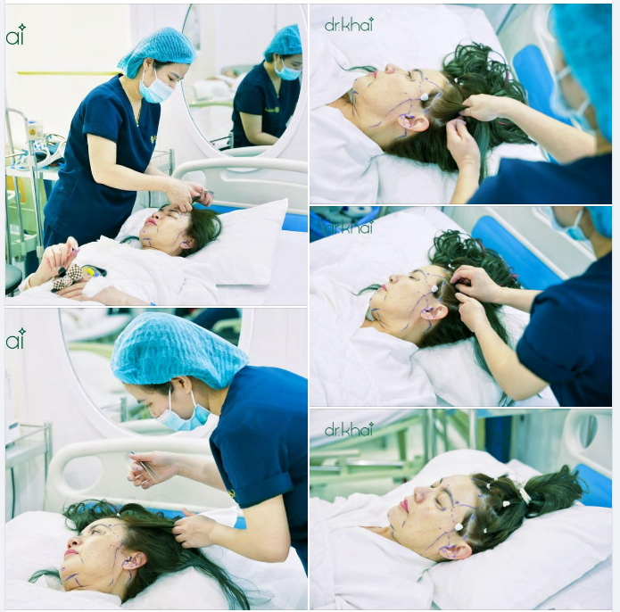 KHÁCH HÀNG THỰC HIỆN DỊCH VỤ ĐỘC QUYỀN TẠI DR KHẢI