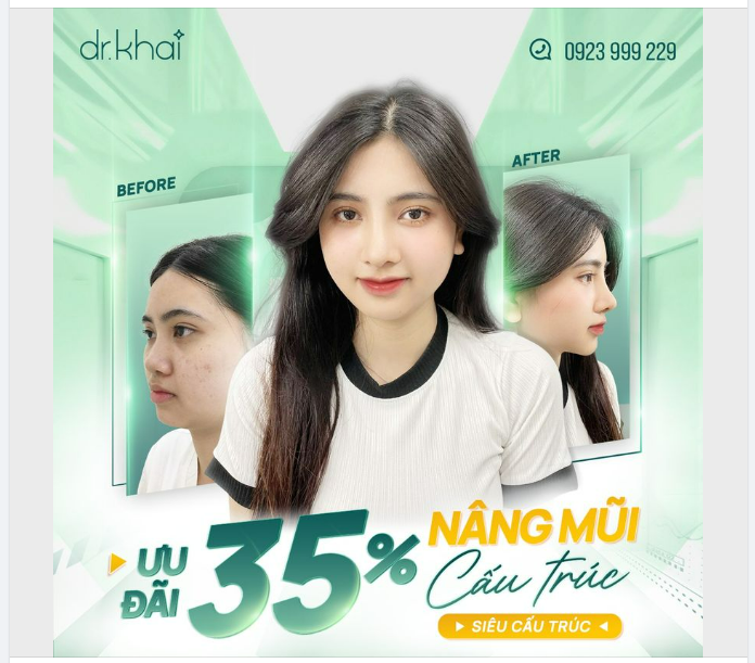 ƯU ĐÃI GIẢM 35% NÂNG MŨI CẤU TRÚC VÀ SIÊU CẤU TRÚC