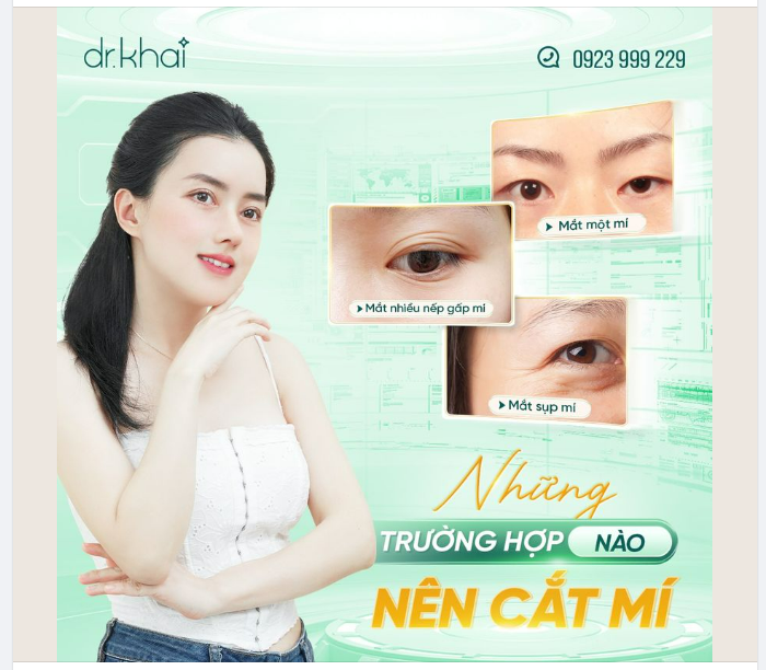 NHỮNG TRƯỜNG HỢP NÀO NÊN CẮT MÍ?