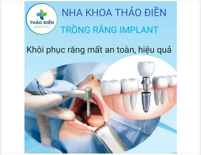 CẤY IMPLANT - GIẢI PHÁP KHÔI PHỤC RĂNG MẤT AN TOÀN, HIỆU QUẢ