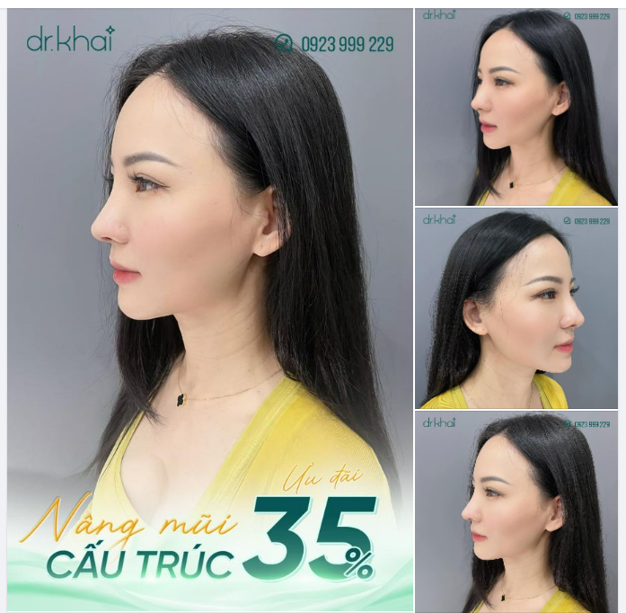 ĐẶT LỊCH LÀM ĐẸP NGAY - ƯU ĐÃI 35% NÂNG MŨI CẤU TRÚC