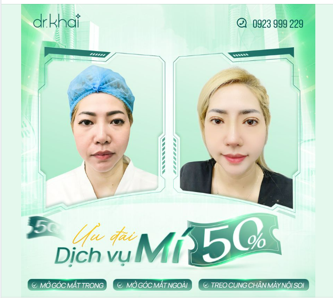 MẮT 2 MÍ ĐẸP MÊ LY - ƯU ĐÃI 50% CÁC DỊCH VỤ MÍ