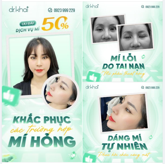 KHẮC PHỤC TÌNH TRẠNG MÍ HỎNG SAU 60 PHÚT DÁNG MÍ TỰ NHIÊN - PHỤC HỒI CHỨC NĂNG CỦA MẮT