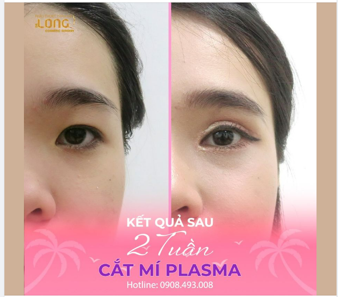 ĐỪNG BỎ LỠ CHỊ EM ƠI INBOX LIỀN TAY CÓ MÍ ĐẸP NGAY