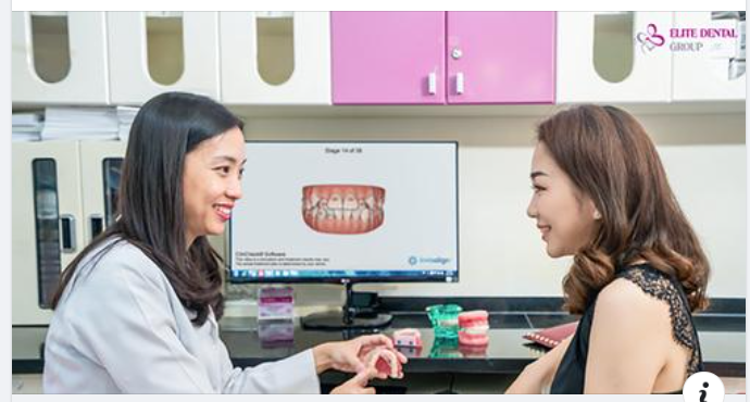 Những ca ở mức độ nặng như cắn sâu, hô/móm xương, khách hàng niềng răng trong suốt cần kết hợp thêm một số nút gắn trên răng, mắc cài hoặc minivis ở một số giai đoạn để di chuyển răng hiệu quả, vững chắc nhất.