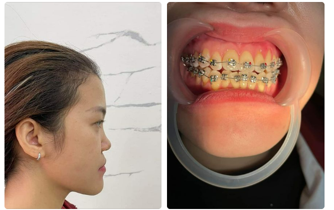 Nha khoa rất vui vì có sự tin tưởng và được khách hàng trải nghiệm dịch vụ tại nha khoa