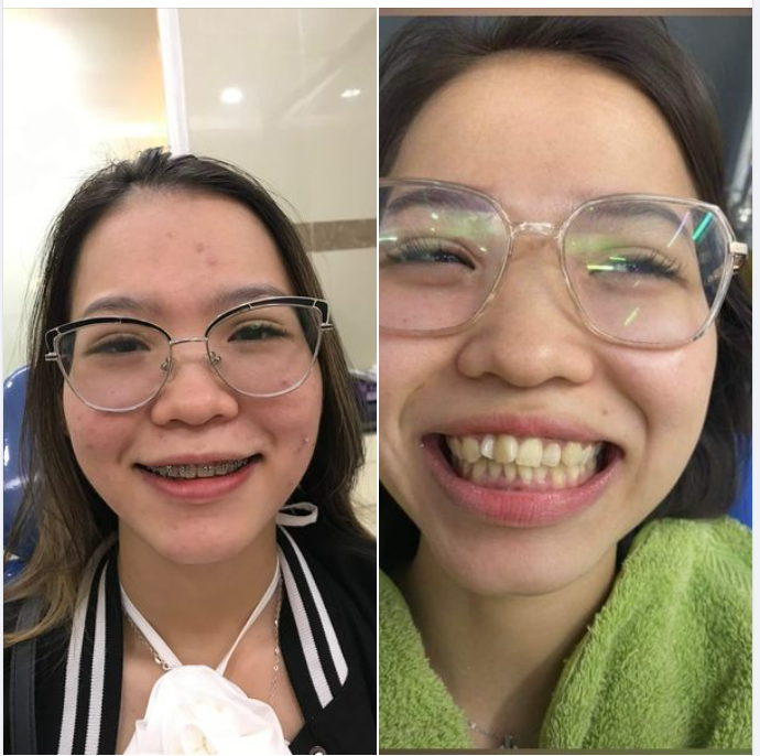 Một trong những niềm tự hào của Nha khoa Thái Tổ là luôn luôn được khách hàng yêu mến sau khi làm và giới thiệu bạn bè, người thân đến để sử dụng dịch vụ tại Nha khoa.