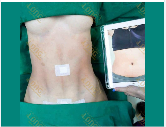 TẠI SAO CÀNG LỚN TUỔI LẠI CÀNG NHIỀU M.Ỡ THỪA
