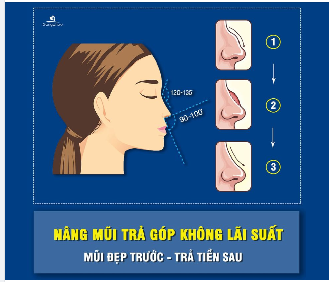 NÂNG MŨI LÀM SAO ĐỂ NÂNG 1 LẦN LÀ ĐẸP LUÔN