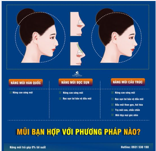 BẠN NÊN CHỌN PHƯƠNG PHÁP NÂNG MŨI NÀO?