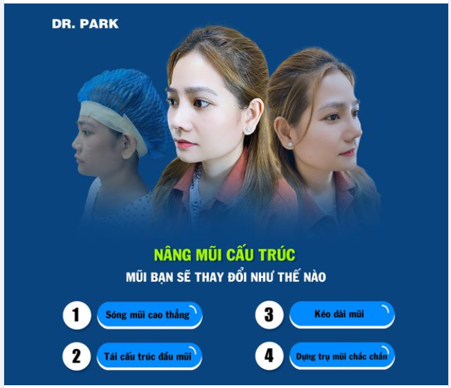 NÂNG MŨI CẤU TRÚC THAY ĐỔI NHỮNG DÁNG MŨI NÀO