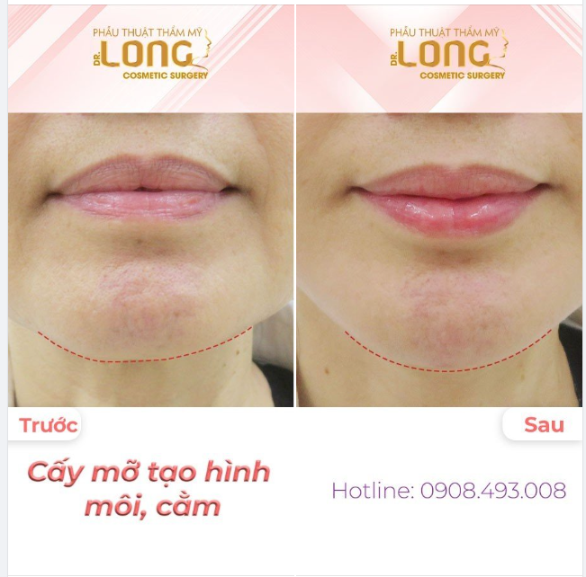 TÌM Ở ĐÂU RA MỘT NƠI NHƯ THẾ???