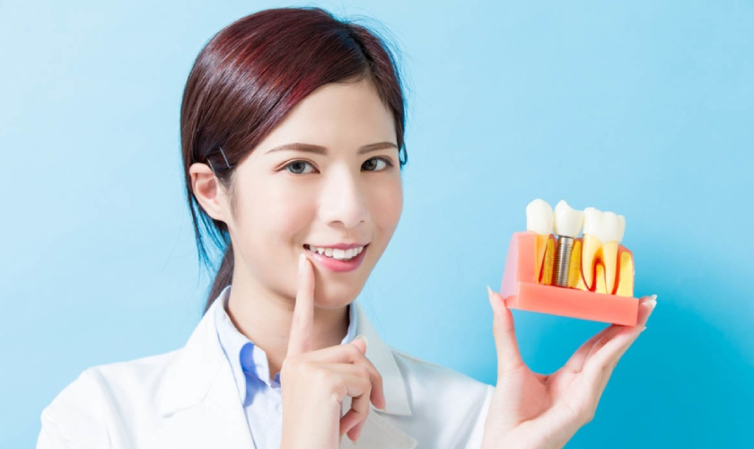 Cấy ghép Implant và những lợi ích tuyệt vời