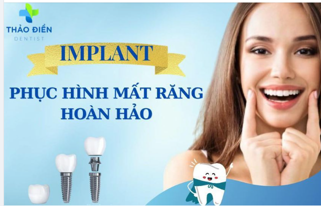 Trồng răng implant phục hình răng mất toàn diện từ chân răng đến mặt ăn nhai