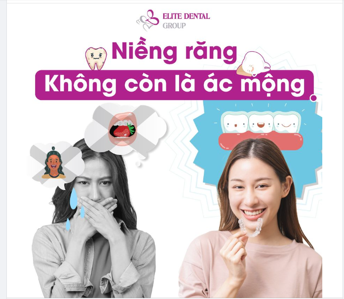 NIỀNG RĂNG - KHÔNG CÒN LÀ ÁC MỘNG